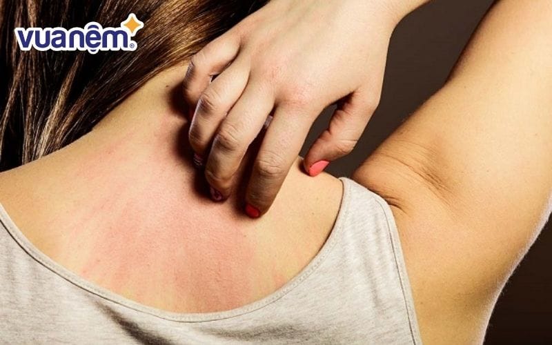 Nệm cũ gây hại lớn đến làn da nên bạn cần thanh lý nệm
