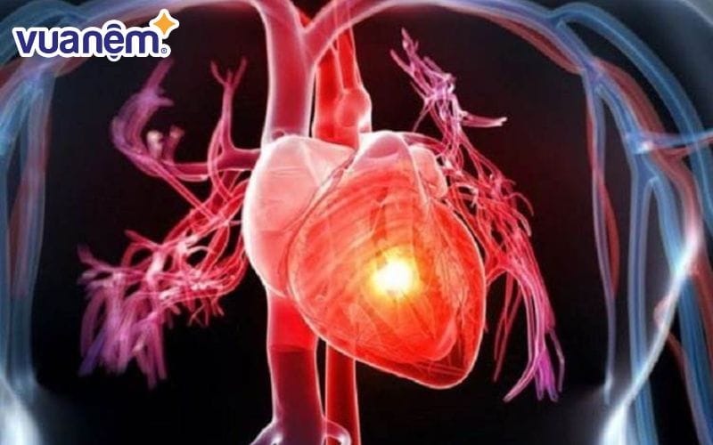 Ảnh hưởng dài hạn của nợ ngủ là tăng nguy cơ mắc bệnh tim mạch, huyết áp