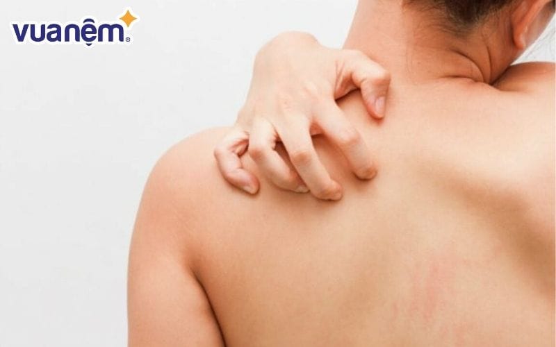 Ngứa, kích ứng vùng vai gáy