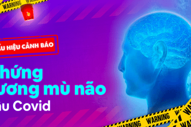 Sương mù não