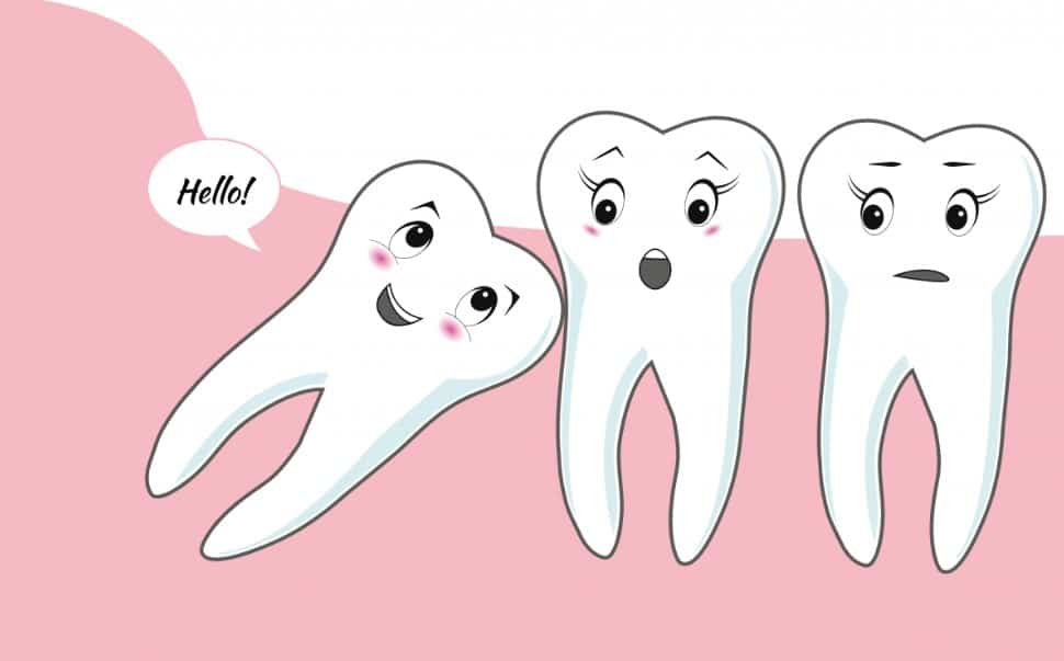 răng khôn là răng gì 
