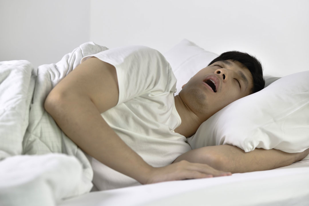 chứng ngưng thở khi ngủ