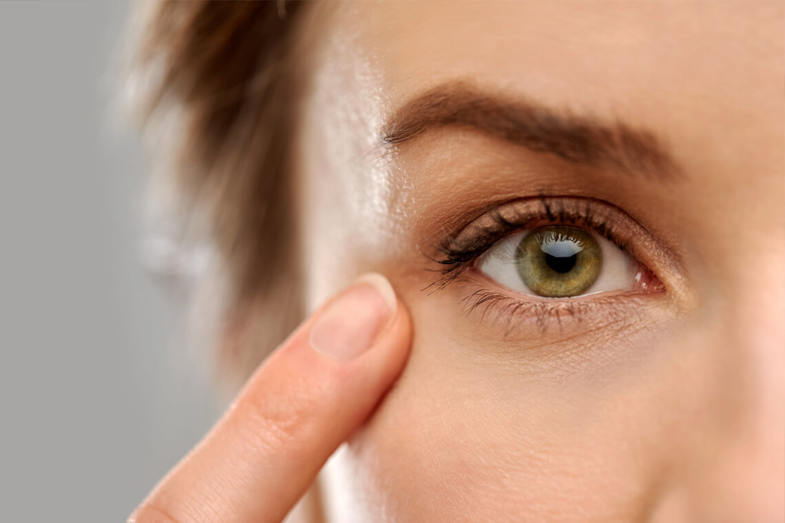 cách chữa sụp mí mắt đơn giản tại nhà