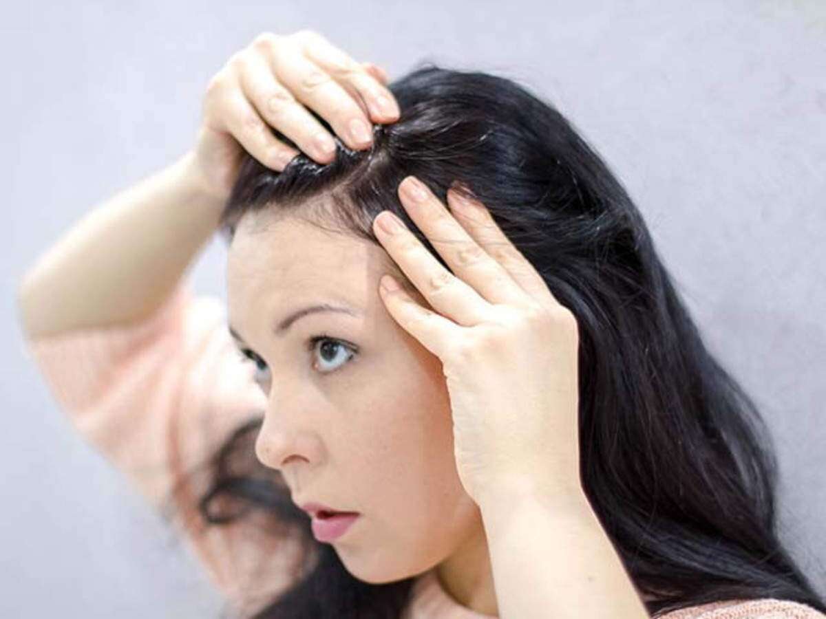 cách trị tóc bạc sớm tại nhà