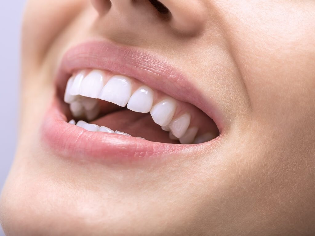 Lấy cao răng định kỳ là cách bảo vệ sức khỏe của răng và xương hàm