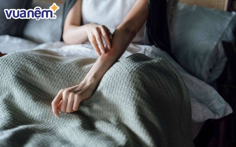 Mẩn ngứa dị ứng khi sử dụng chăn ga gối đệm giá rẻ