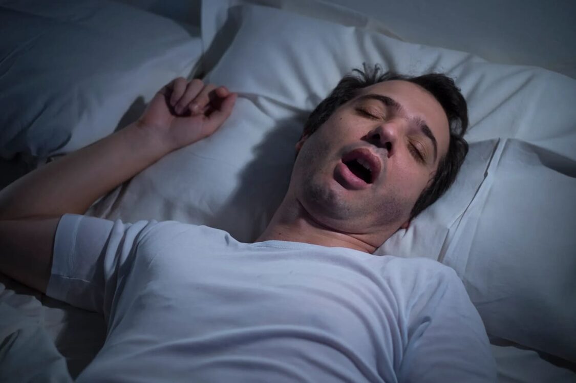 mũi bị lệch khiến ngáy khi ngủ