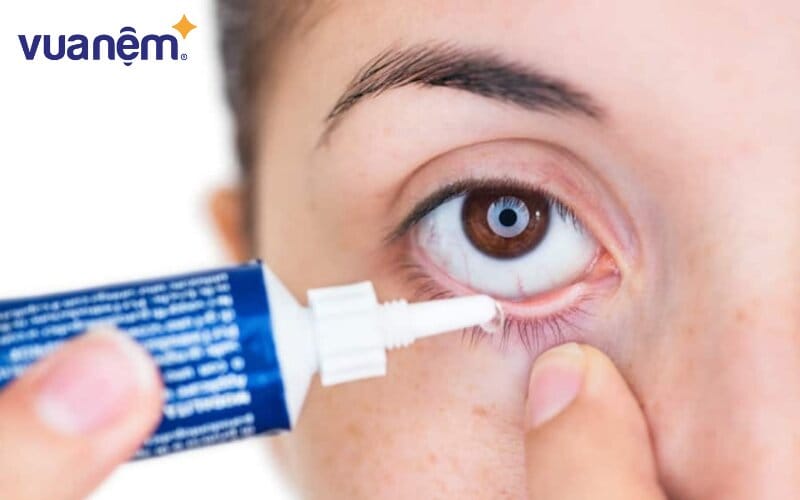 Nếu bị đau mắt mức độ nặng, thông thường bác sĩ sẽ chỉ định dùng thuốc mắt dạng mỡ hoặc gel