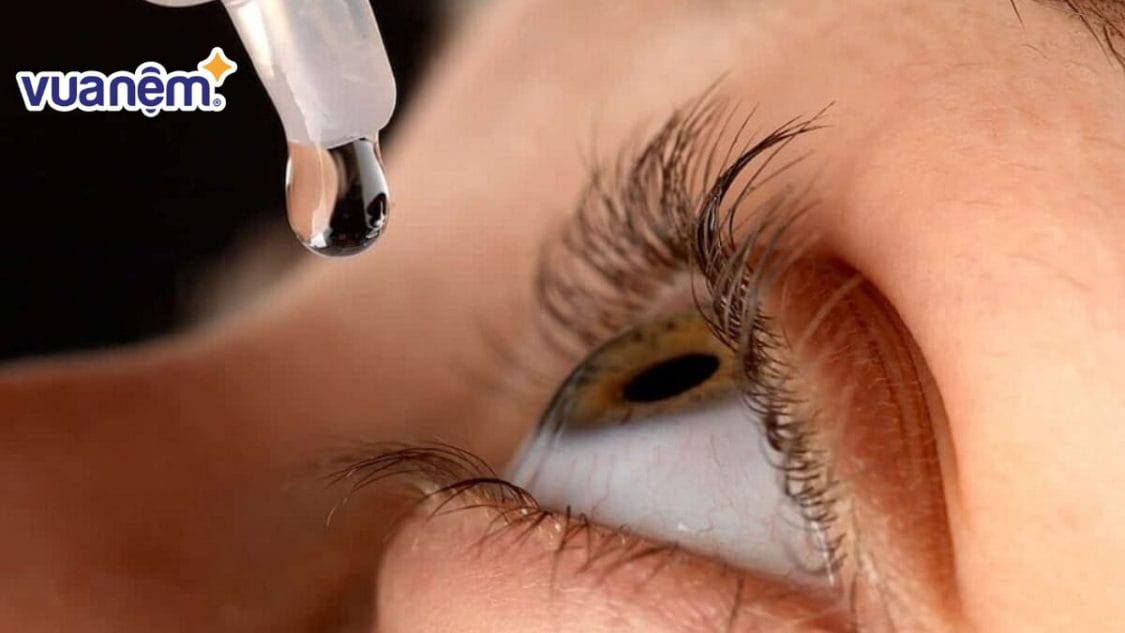 Nhỏ mắt trước lúc ngủ giúp hạn chế tình trạng thuốc bị chảy ra ngoài nhiều