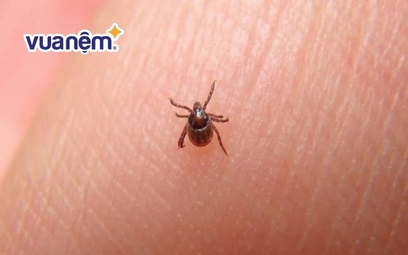 Mạt gà khi cắn vào người có thể gây bệnh cho người