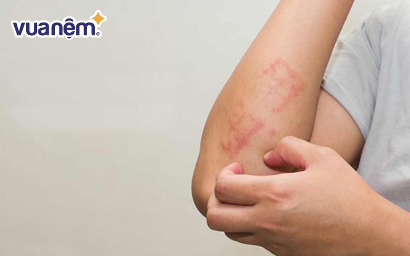 Nệm bị ẩm mốc gây ra các bệnh về da liễu